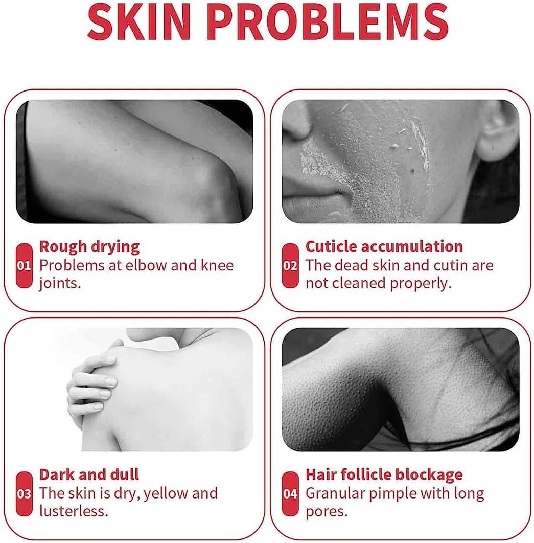 Peach Extract Exfoliation, Peach Extract Fruit Acid Exfoliating Face Gel