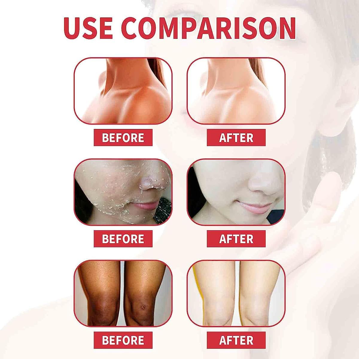 Peach Extract Exfoliation, Peach Extract Fruit Acid Exfoliating Face Gel