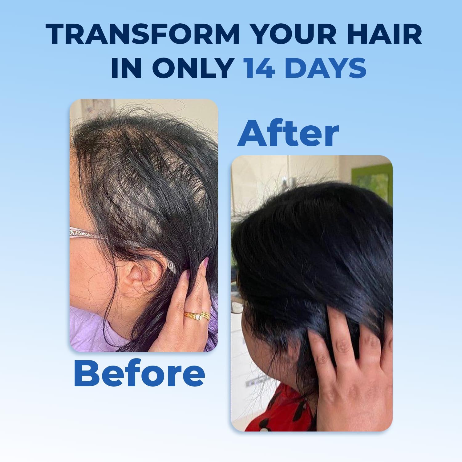 FEGPLUS Rosemary Beard & Hair Growth Serum (50ml), Rosemary Extract Serum Hair Spray